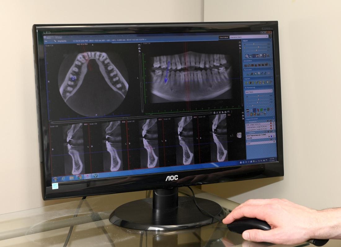 X-ray